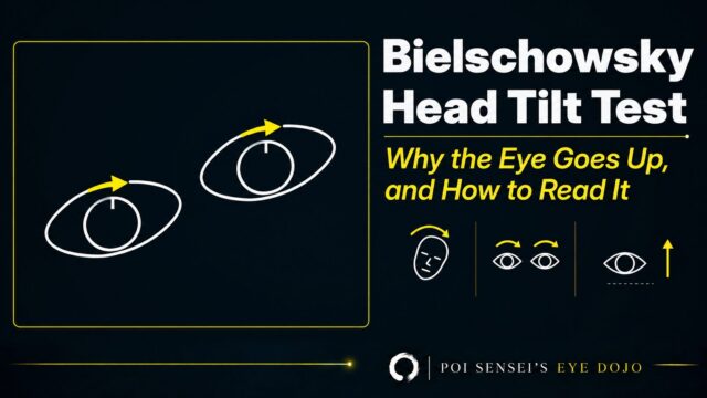 Bielschowsky head tilt test: the eyes counter-roll when the head tilts, and in superior oblique palsy the affected eye goes up