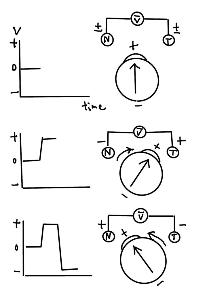 Hand-drawn diagram: nasal (N) and temporal (T) electrodes wired to a voltmeter across an eye drawn as a dipole. When the cornea turns toward the temporal electrode the trace steps positive; when it turns toward the nasal electrode the trace steps negative