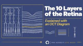 The 10 layers of the retina, explained with an OCT diagram. Line drawings of retinal neurons beside the matching OCT bands, with the ellipsoid zone highlighted