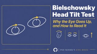 Bielschowsky head tilt test: the eyes counter-roll when the head tilts, and in superior oblique palsy the affected eye goes up
