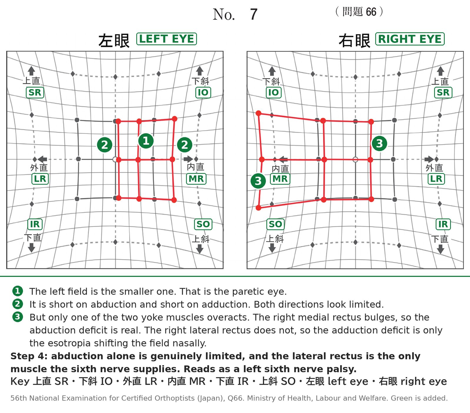 The same Hess chart with the reading steps marked