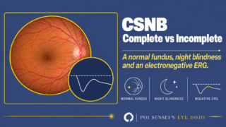 CSNB: complete vs incomplete. A normal fundus photograph with an inset of an electronegative ERG trace