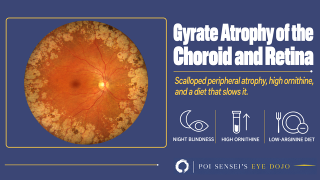 Gyrate atrophy of the choroid and retina: fundus with scalloped peripheral atrophy, high ornithine and a low-arginine diet