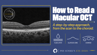 How to Read a Macular OCT: a normal macular OCT scan through the fovea with a fundus drawing showing the scan line.