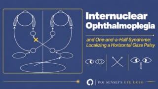 Internuclear ophthalmoplegia and one-and-a-half syndrome: the horizontal gaze pathway seen from above