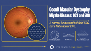 Occult macular dystrophy: a normal fundus with a multifocal ERG that is flat in the center