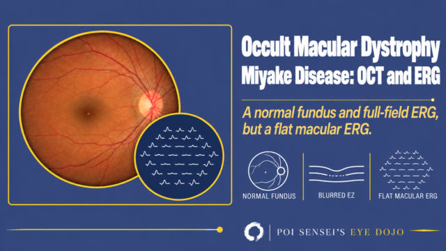 Occult macular dystrophy: a normal fundus with a multifocal ERG that is flat in the center