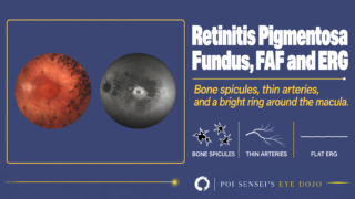Retinitis Pigmentosa: Fundus, FAF and ERG