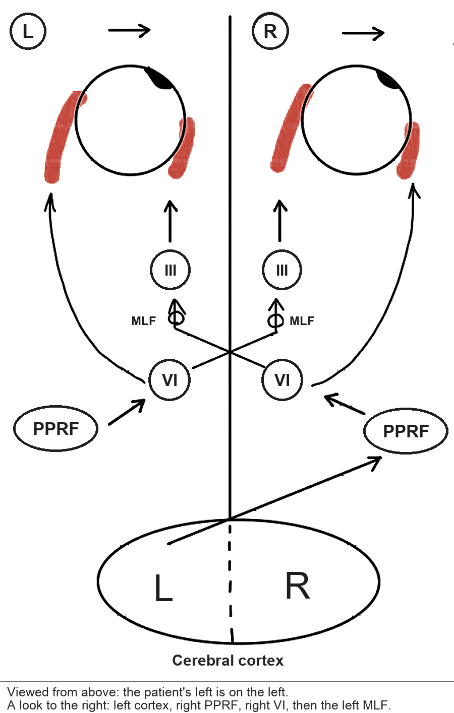 The pathway for looking to the right, viewed from above. The left cerebral cortex sends the signal to the right PPRF, then to the right VI nucleus and the right lateral rectus. Fibers from the right VI nucleus cross the midline, run up in the left MLF to the left III nucleus and the left medial rectus.