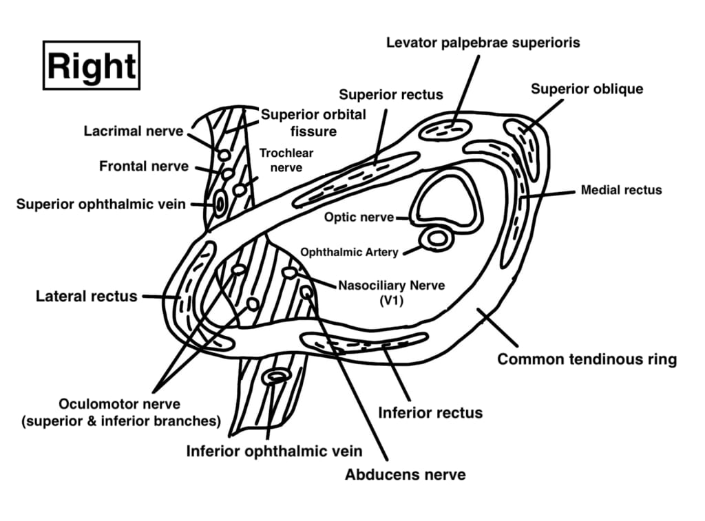 Right orbital apex: the common tendinous ring and the nerves, vessels and muscles that pass through it