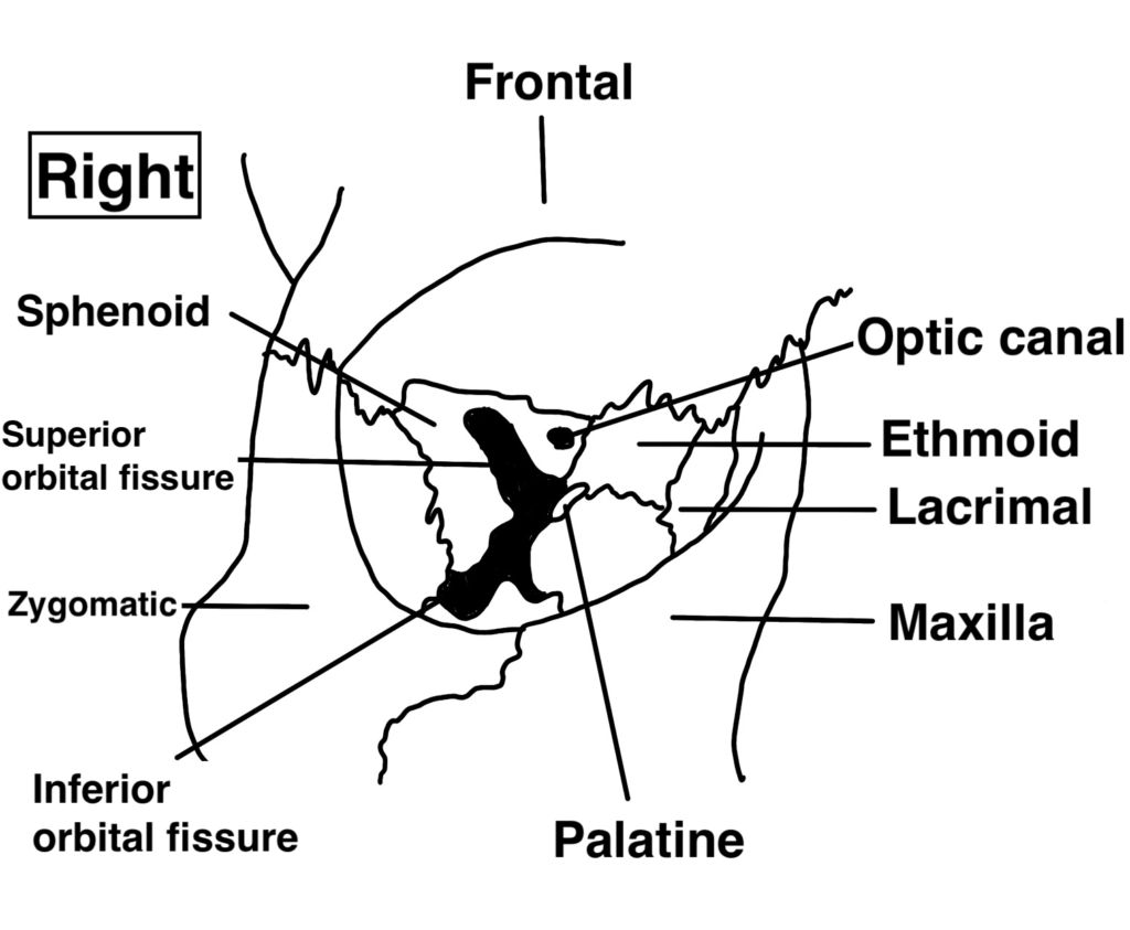 Right orbit: the seven bones of the orbital walls
